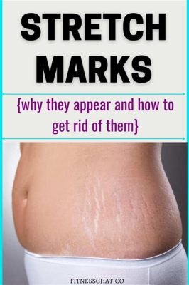 How to Prevent Stretch Marks from Working Out: Unlocking the Secrets to Skin Resilience and Beyond